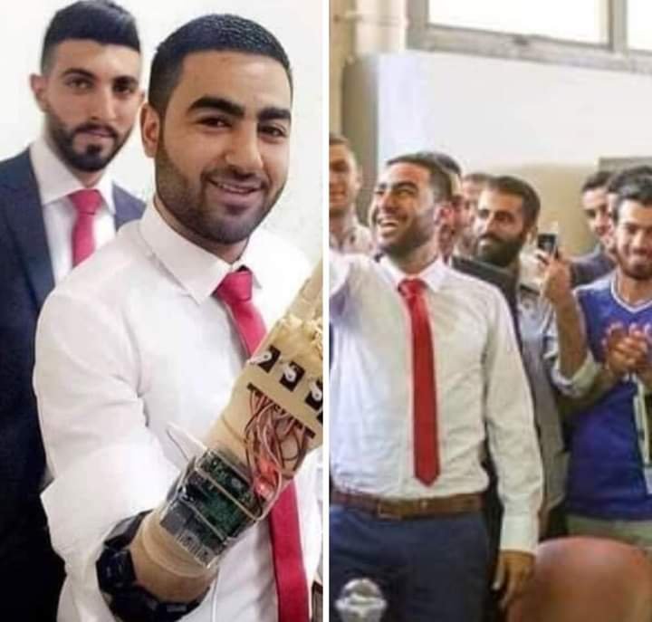 بتر الاحتلال يده فتحدى اعاقته